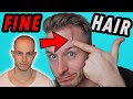 Getting a Hair Transplant with Fine Hair? Tips and Tricks!