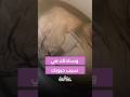 وسادتك طلعت سبب حبوبك