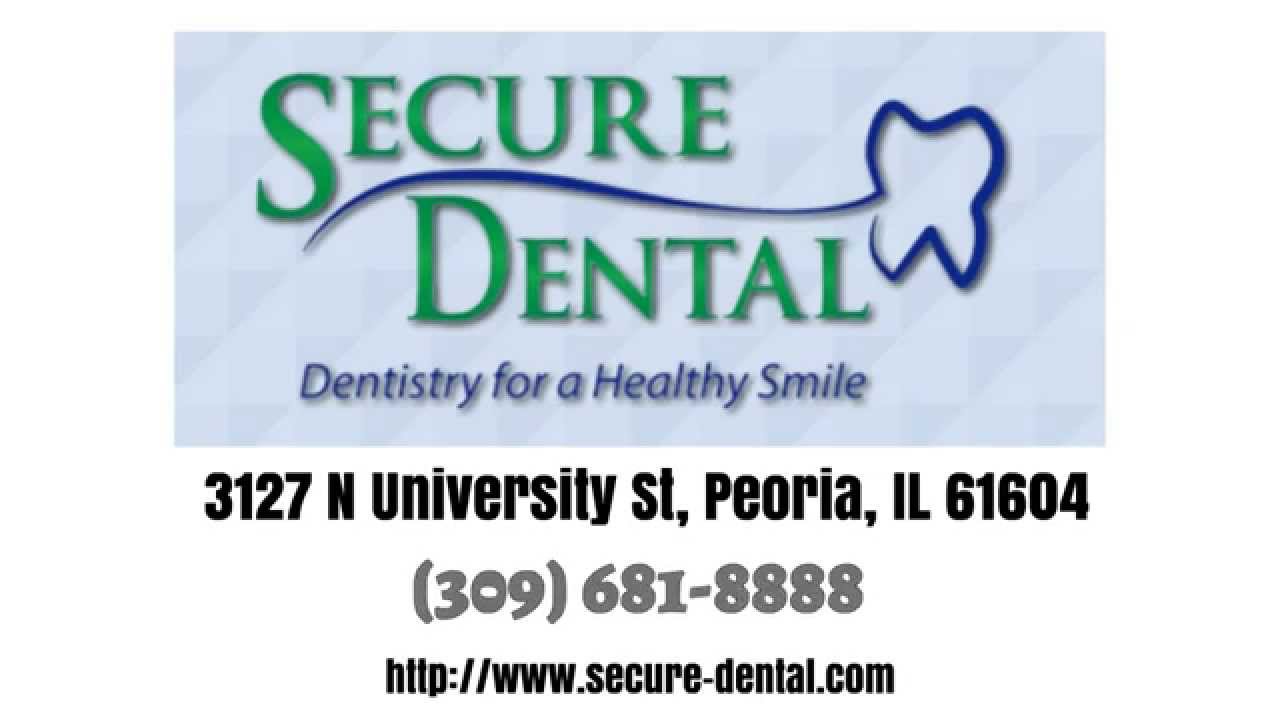 Secure Dental Peoria (309) 6818888 REVIEWS Dentists Peoria