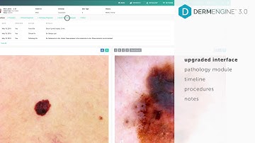 Introducing DermEngine 3.0