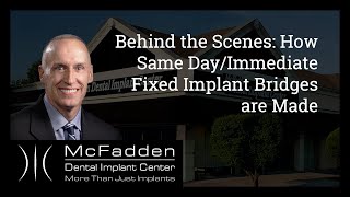 Behind the Scenes: How Same Day/Immediate Fixed Implant Bridges are Made