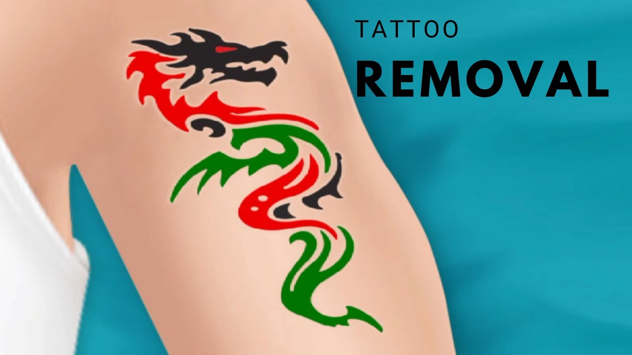 how to remove tattoo permanently at home/ टैटू को कैसे हटाएं YouTube