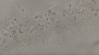 Contaminated floodwater swirls with risk for serious infection