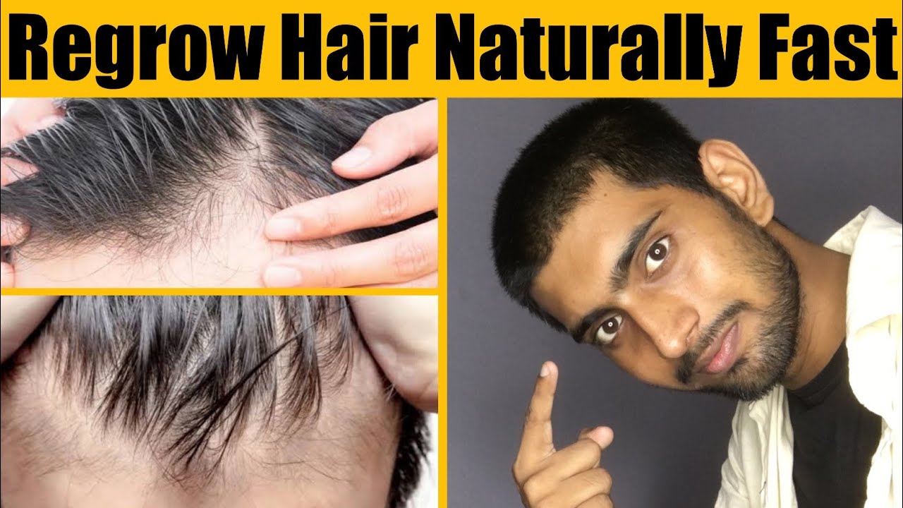 How To Regrow Hair Fast Within 1month 100 Guaranteed Grow Baby