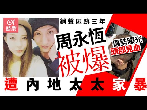周永恆銷聲匿跡三年突被爆遭內地太太家暴　傷勢曝光頭部受傷見血｜01娛樂｜周永恆｜陳薇｜香港藝人