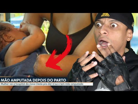 MULHER VAI A HOSPITAL NO RIO DE JANEIRO FAZER PARTO E VOLTA COM MÃO AMPUTADA
