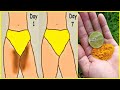 How to Lighten Private Areas Naturally !! 100% Works at home ! Dr Heng Soy