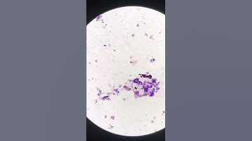 Gram Stained urine #laboratory #microscope #mls #cls #cells #epithelialcells #gramstain