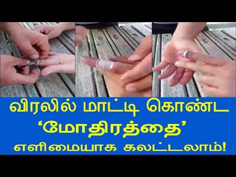 விரலில் "மாட்டி கொண்ட" மோதிரத்தை எளிமையாக கலட்டலாம்! | Easy Way to Remove Ring from Finger