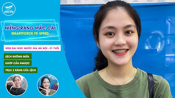 Trương Thị Huyền Trang, niềng răng mắc cài khắc phục tình trạng lệch đường giữa, khớp cắn ngược