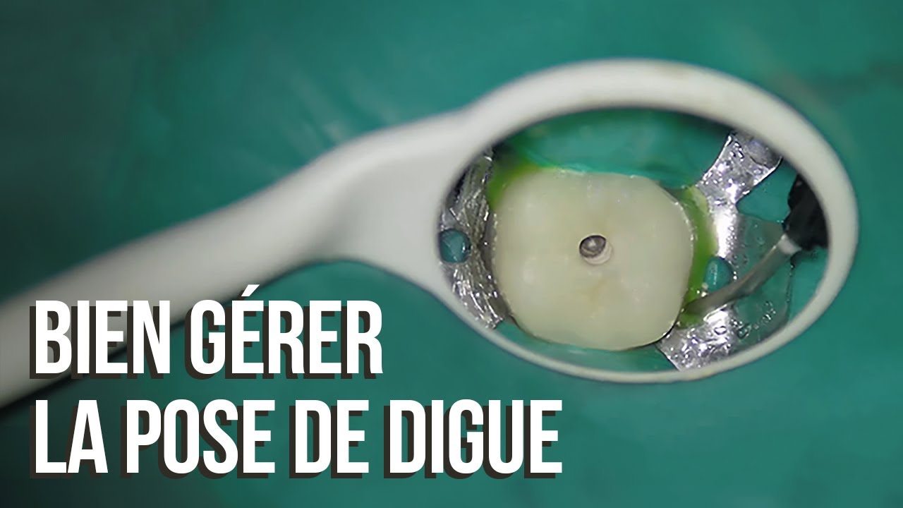 🤓 La pose de digue en endo