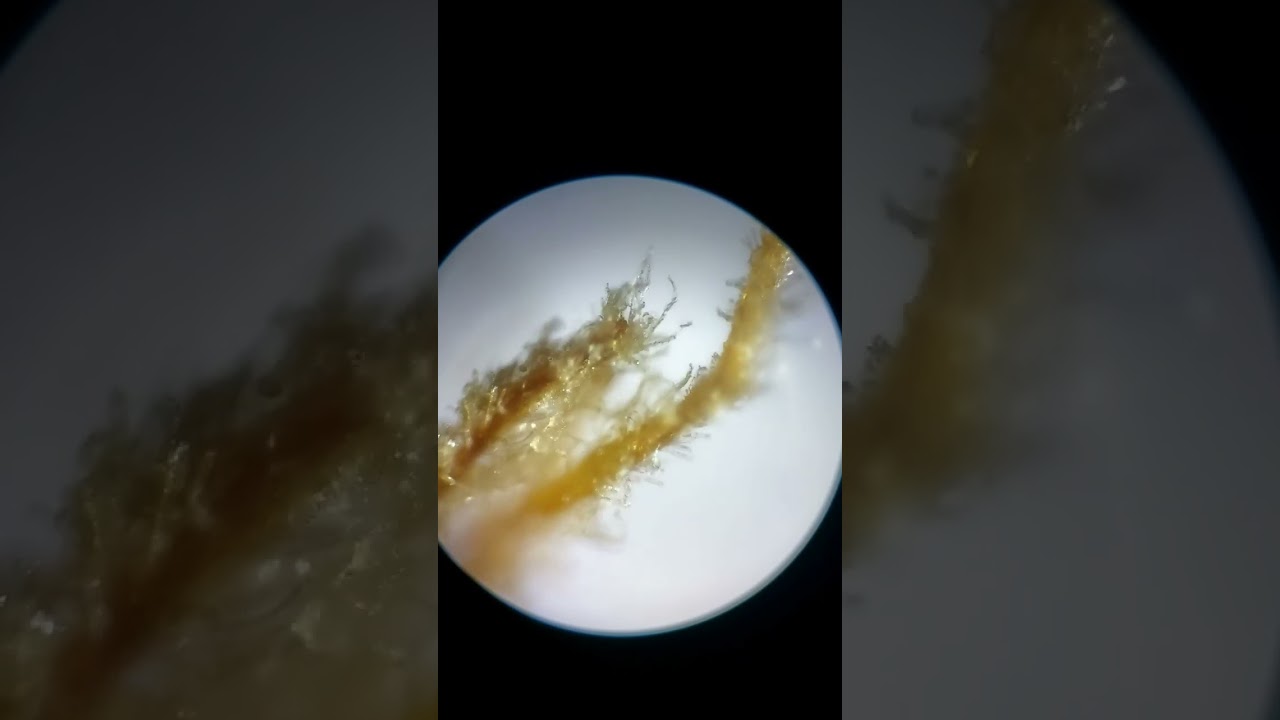 Cannabis trichomes at 100x magnification.