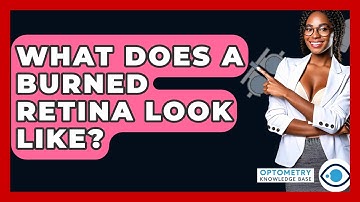 What Does A Burned Retina Look Like? - Optometry Knowledge Base