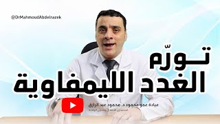 تورّم الغدد الليمفاوية في الأطفال - دكتور محمود عبد الرازق