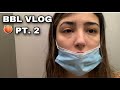 BBL JOURNEY | POST OP VLOG DAYS 3-7 **BODY UPDATE**