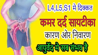 sciatica का दर्द क्यों होता है sciatica रोग का उपचार क्या है sciaticapain