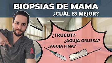 ¿Cuál es la diferencia entre una biopsia por punción y una biopsia con aguja gruesa?