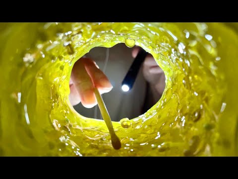 【ASMR】耳の中視点でスッキリ耳垢除去👂✨ Ear Canal POV Ear Cleaning【音フェチ】