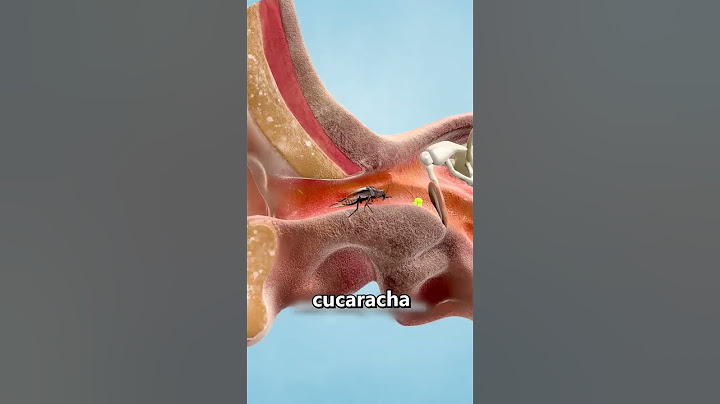 What to do if a cockroach gets in your ear? 😨