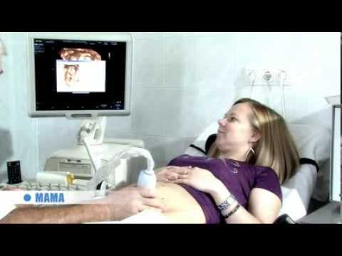 Videó: 2 Hetes Terhesség - Első Jelek és érzések, Teszt, Ultrahang