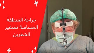 جراحة المنطقة الحساسة تصغير الشفرين