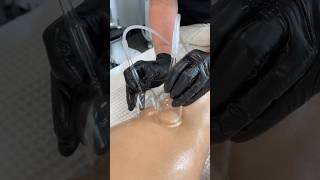 Zemits Leger 2.0 offers vacuum therapy for lymphatic drainage on the face and body ✨