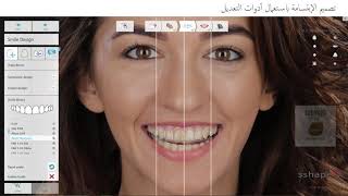 Celebrity Digitized 3Shape Smile Design 2021 Workflow Net Worth