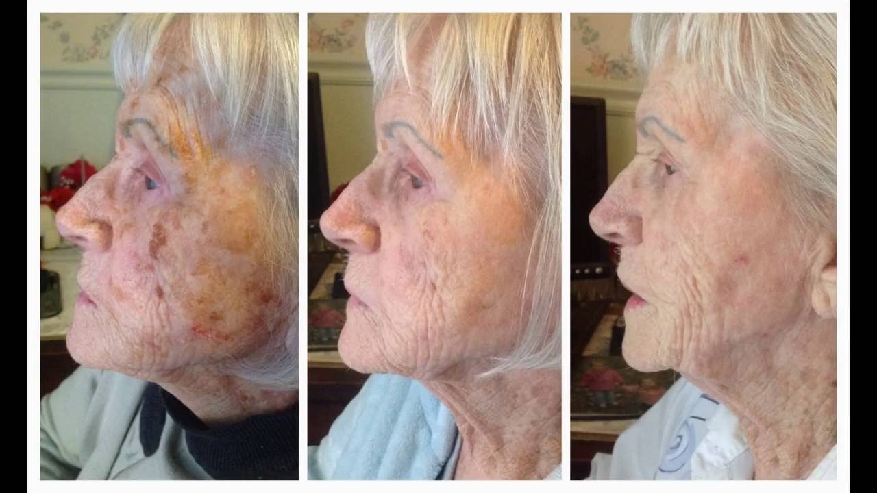 Local NeriumAD Before & After Pictures REAL Results