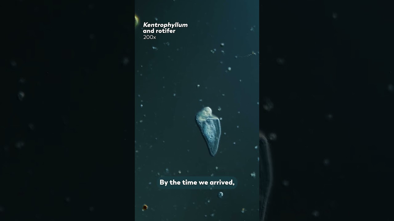 This Rotifer Is Still Alive After Being Swallowed