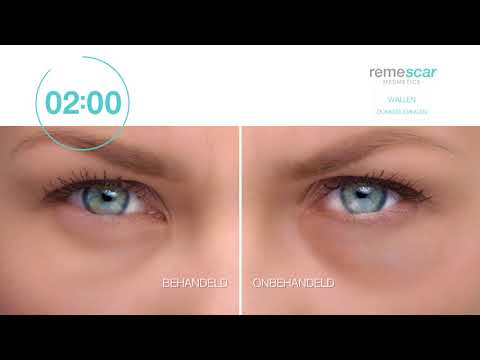 religie deuropening Opstand Remescar Eye Bags & Dark Circles demovideo Kruidvat - YouTube