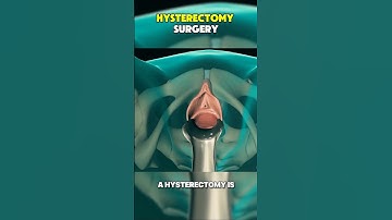 Hysterectomy Procedure 3D Animation #hysterectomy #hysterectomyrecovery #hysteroscopy #3danimation