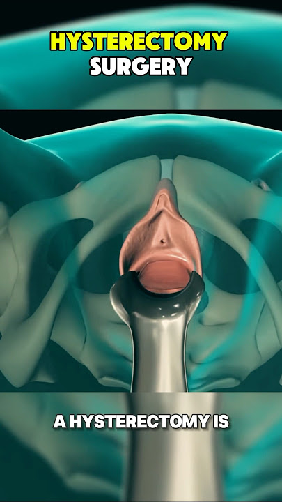 Hysterectomy Procedure 3D Animation #hysterectomy #hysterectomyrecovery #hysteroscopy #3danimation