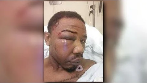 Federal Matters: Police Chief Charged With Hate Crime/ The D.A Gets Indicted