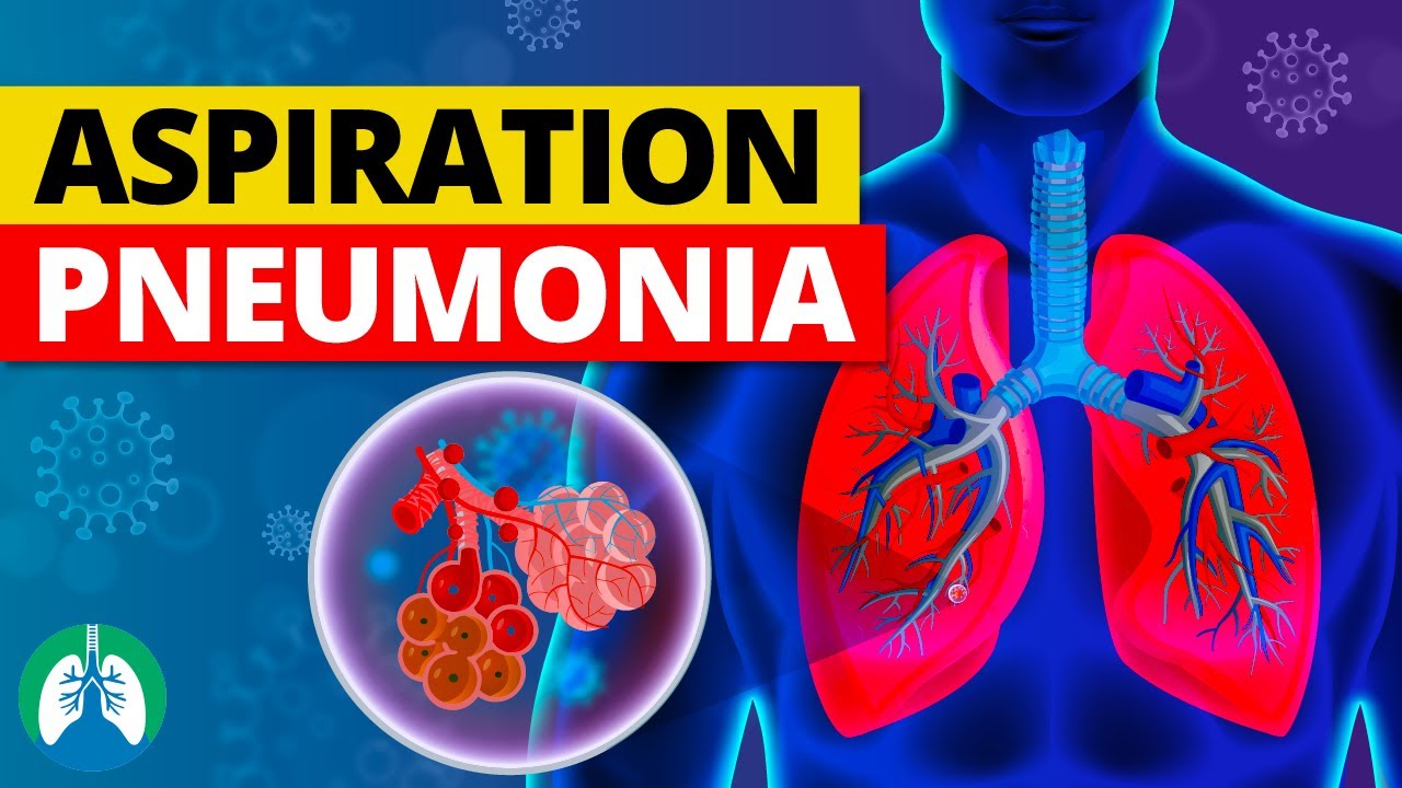 Aspiration Pneumonia (Medical Definition) | Quick Explainer Video - YouTube
