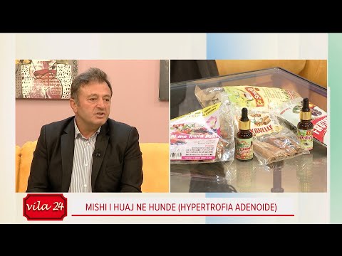 Video: Pse krijohet mukus në hundë?