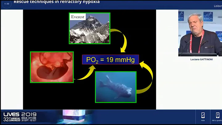 Rescue techniques in refractory hypoxia Luciano Ga...