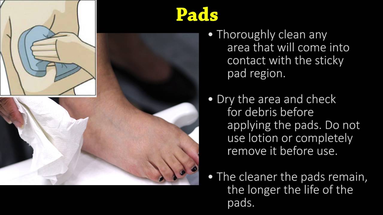 How To Place Pads For The TENS Unit And Long Term Maintenance Part 3 Of 