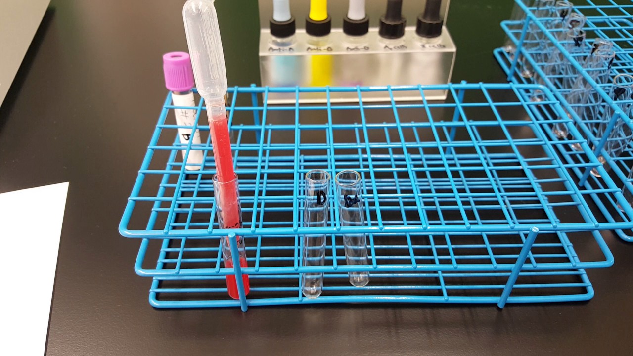 Blood Banking: Weak D test Part 1 - YouTube