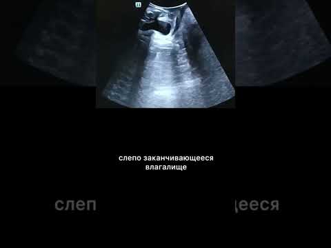 #узитазовогодна