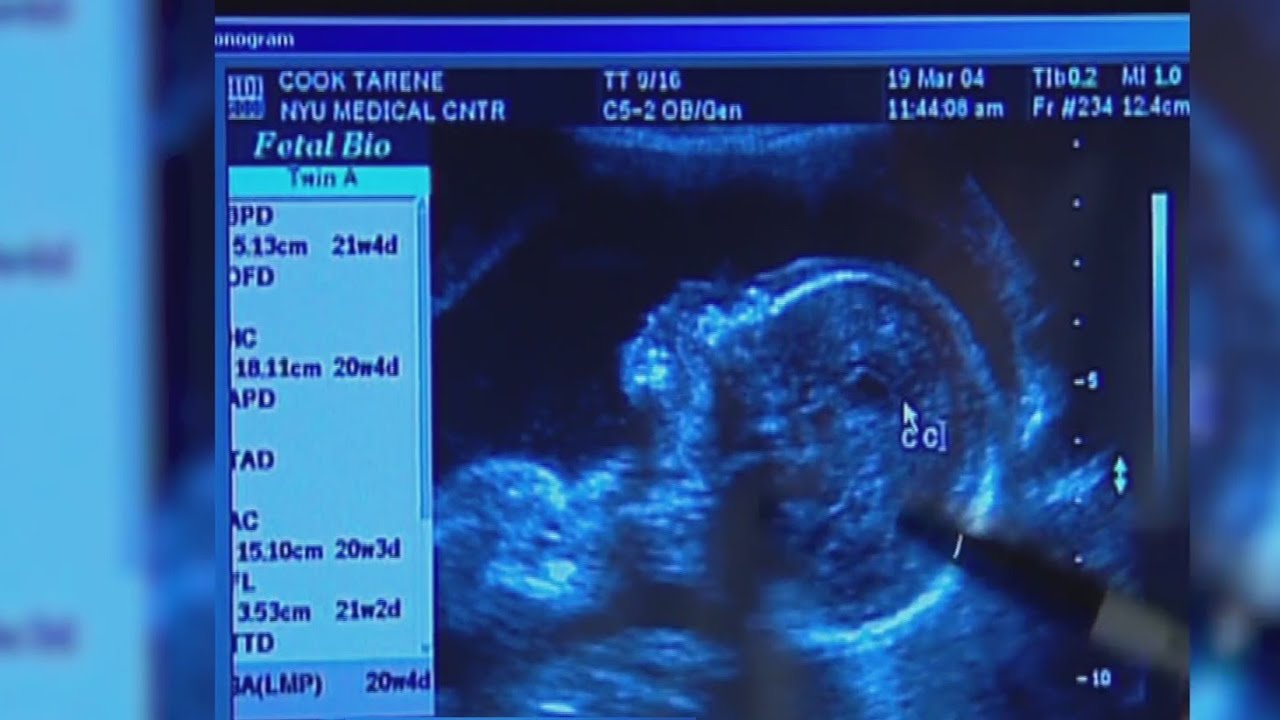 Postpartum pill appears to be working for many women