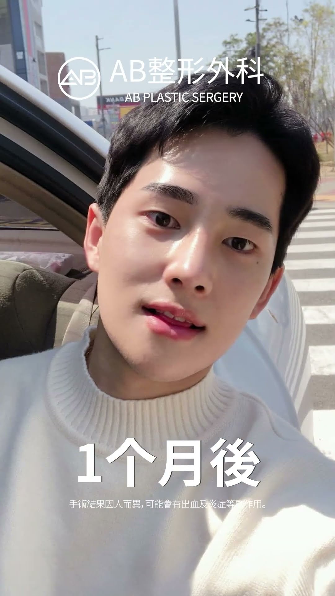 变美：鼻子与下颌版！#短视频 #fyp #推荐