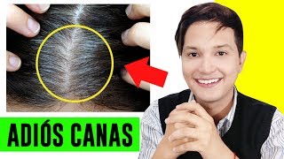 COMO ELIMINAR LAS CANAS NATURALMENTE CON REMEDIOS CASEROS | AndyZarturno