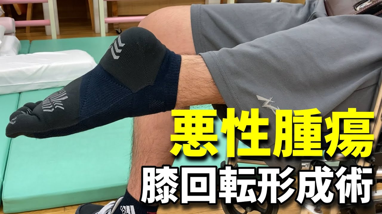 A man undergoes rotationplasty for tumor - YouTube