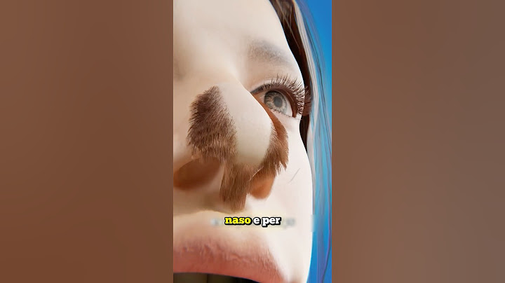 LA RAGAZZA CON I PELI SUL NASO, UNA CONDIZIONE RARISSIMA (credits: ​⁠@zackdfilms)