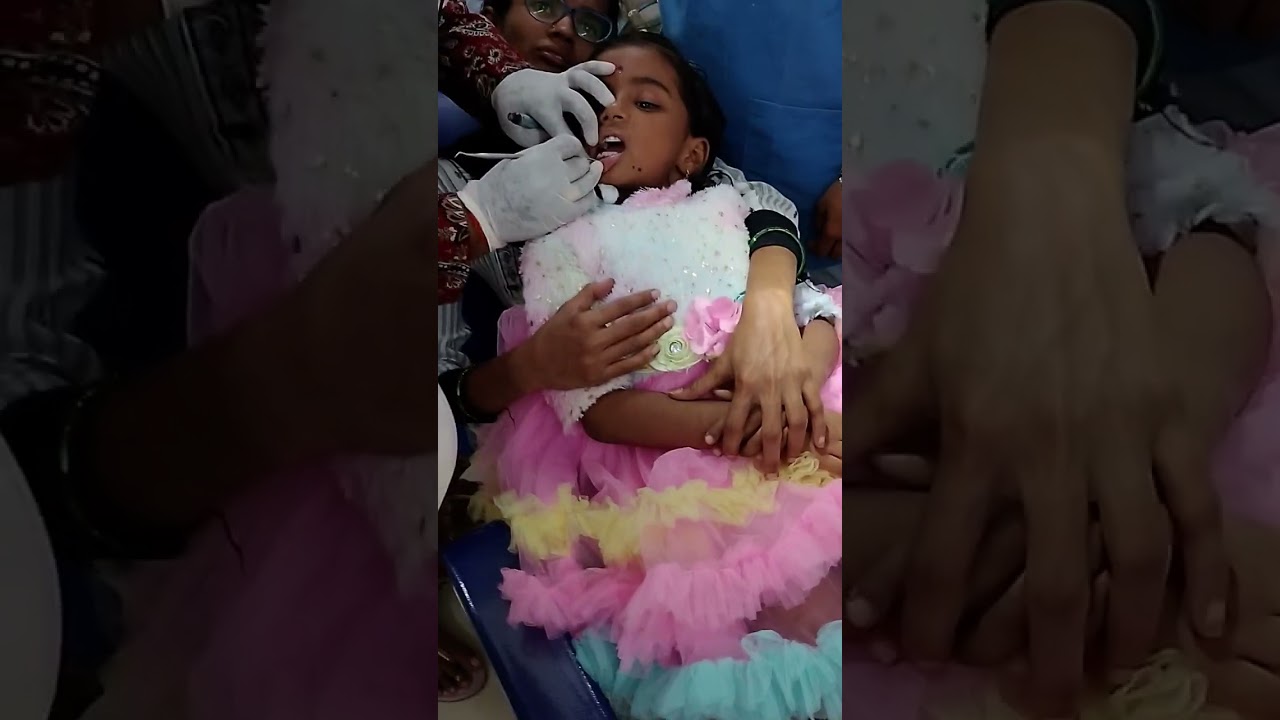 “Child Teeth Cavity in Telugu – Symptoms, Treatment, Prevention”