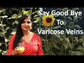 Best Natural Home Remedy To Cure Varicose Veins /  Get Relief from Varicose Vein Pain