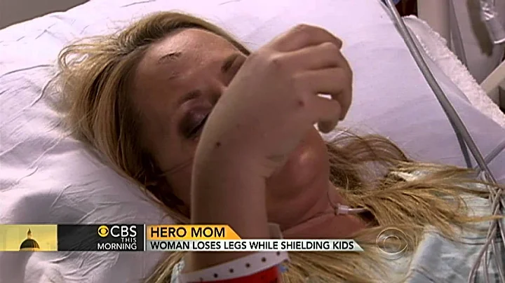 Mom loses parts of legs saving kids from twister