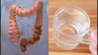 Clean the colon in days, the foul waste will come out, and the constipation will disappear