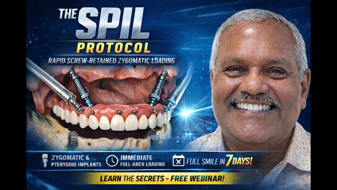 🦷 SPIL Protocol Explained | ⚡ Rapid Screw-Retained Zygomatic Loading for Full-Arch Implants