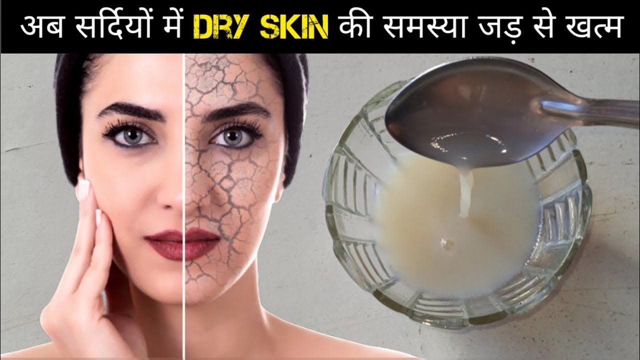 winter-dry-skin-care-home-remedies-how-to-get-rid-of-dry-skin-in